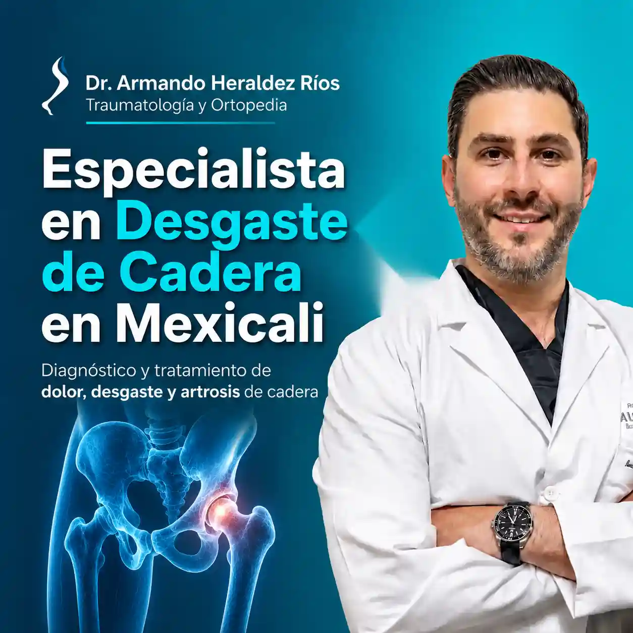 especialista en desgaste de cadera mexicali